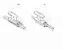 Fig. 04 - Orthodontic device