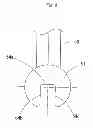 Fig. 16 - Orthodontic device