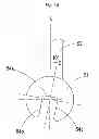 Fig. 18 - Orthodontic device