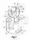 Fig. 02 - ORTHODONTIC ARCHWIRE BRACKET