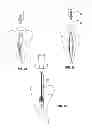 Fig. 03 - Endodontic file