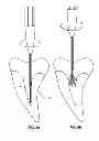Fig. 05 - Endodontic file