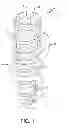 Fig. 02 - Dental Implant and Method of Implantation