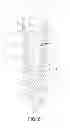 Fig. 06 - Dental Implant and Method of Implantation
