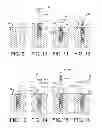 Fig. 07 - Dental Implant and Method of Implantation