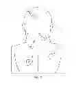 Fig. 03 - Cutaneous surgical training model of the head, neck and shoulders