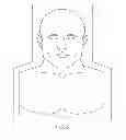 Fig. 04 - Cutaneous surgical training model of the head, neck and shoulders