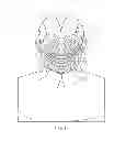 Fig. 07 - Cutaneous surgical training model of the head, neck and shoulders
