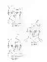 Fig. 16 - Cutaneous surgical training model of the head, neck and shoulders