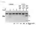 Fig. 09 - Method for concentrating cells that are genetically altered by nucleases