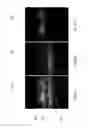 Fig. 09 - Test element for detecting an analyte in a sample