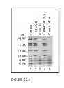 Fig. 15 - Method for harvesting nanoparticles and sequestering biomarkers