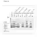 Fig. 17 - Method for harvesting nanoparticles and sequestering biomarkers