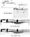 Fig. 02 - High voltage device and manufacturing method thereof
