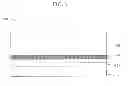 Fig. 04 - Systems and methods for preparation of epitaxially textured thick films