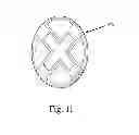 Fig. 11 - Yo-yo with an accessory attachment system and a movable string bead