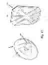 Fig. 12 - Yo-yo with an accessory attachment system and a movable string bead