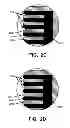 Fig. 04 - Putter heads and putters including polymeric material as part of the ball striking face