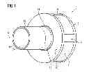 Fig. 02 - Planetary carrier