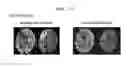 Fig. 22 - Composition for aiding surgical procedures for treating ischemic vascular diseases