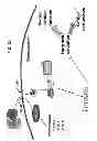 Fig. 33 - Methods for Treating and Preventing Cardiac Dysfunction in Septic Shock