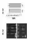 Fig. 43 - Methods for Treating and Preventing Cardiac Dysfunction in Septic Shock