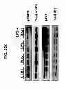 Fig. 47 - Methods for Treating and Preventing Cardiac Dysfunction in Septic Shock