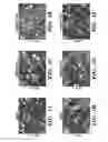 Fig. 02 - Methods of promoting neuronal outgrowth by gypican 2 that binds to receptor protein tyrosine phosphatase sigma