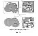 Fig. 07 - Method for inhibiting autophagy of motor neurons