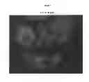 Fig. 04 - Compounds for the treatment of proliferative disorders
