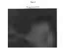 Fig. 07 - Compounds for the treatment of proliferative disorders