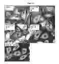 Fig. 20 - Compounds for the treatment of proliferative disorders