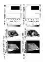 Fig. 02 - Use of pyruvate or succinate to enhance the efficacy of a hypoxia activated prodrug for the treatment of tumors