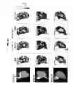 Fig. 08 - Use of pyruvate or succinate to enhance the efficacy of a hypoxia activated prodrug for the treatment of tumors