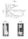 Fig. 02 - CORROLES FOR NEUROPROTECTION AND NEURORESCUE