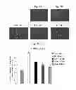 Fig. 25 - CORROLES FOR NEUROPROTECTION AND NEURORESCUE