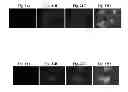 Fig. 31 - CORROLES FOR NEUROPROTECTION AND NEURORESCUE