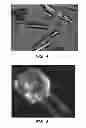 Fig. 05 - Crystalline form of a 4-[2-(2-fluorophenoxymethyl) phenyl]piperidine compound