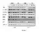 Fig. 10 - HSP90 INHIBITORY COMPOUNDS IN TREATING JAK/STAT SIGNALING-MEDIATED CANCERS