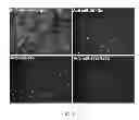 Fig. 02 - Composition containing antisense oligonucleotide to micro RNA