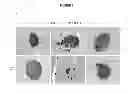 Fig. 07 - GENE THERAPY COMPOSITIONS FOR PREVENTING AND/OR TREATING OF AUTOIMMUNE DISEASES