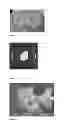 Fig. 02 - OIL BODY EXTRACTION AND USES