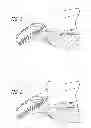 Fig. 02 - Intracameral sustained release therapeutic agent implants