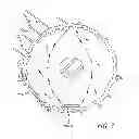 Fig. 03 - Intracameral sustained release therapeutic agent implants