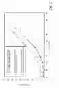 Fig. 05 - Intracameral sustained release therapeutic agent implants