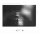 Fig. 06 - Intracameral sustained release therapeutic agent implants