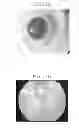 Fig. 05 - SYNTHETIC VITREOUS MATERIAL