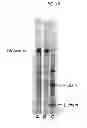 Fig. 17 - Method of purifying protein