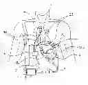 Fig. 01 - Ventricular assist device cannula and ventricular assist device including the same