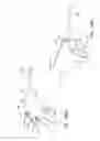 Fig. 69 - Methods and systems for performing a medical procedure